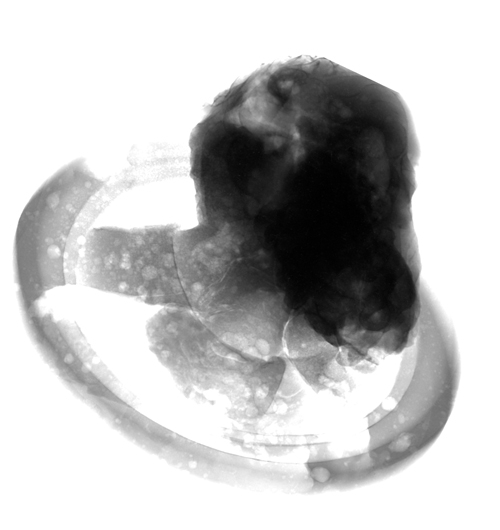 Radiographie d’une tête de prophète de la Porte du Paradis de Florence: on voit en haut à droite un trou (blanc) qui, selon le Prof. Giuseppe Gorini, n’a été bouché que plus tard.